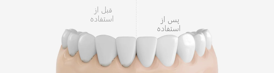 دستگاه شستشوی دهان و دندان شیائومی